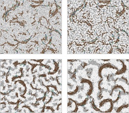 FtsZ protein filaments and lipid segregation. González de Prado Salas